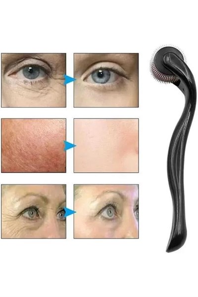Dermaroller Titanyum 540 Iğneli 1 Mm Saç Kaş Sakal Serum Kullanıma Uygun