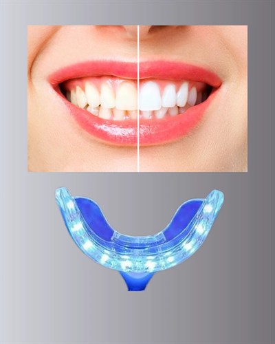 Mavi Işık Teknolojisi ile Güvenli Diş Beyazlatıcı Sistem