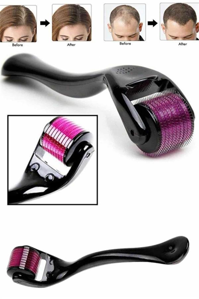Derma Roller Titanyum Uçlu 540 İğneli 1 Mm Saç Sakal Çıkarma Ve Cilt Bakım Masaj Aleti
