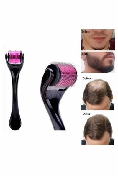 Saç Çıkarma Tarağı Dermaroller 540 Iğneli Roller 1 Mm Iğne Cilt Yüz Yenileme Bakım Seti