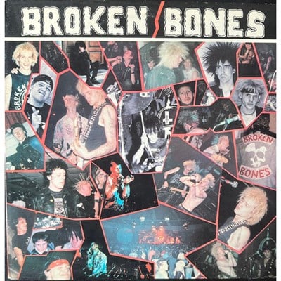 Broken Bones - Never Say Die 12