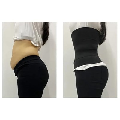 3 Bel İnceltici Korse Vücut Şekillendirici Sıkılaştırıcı Doğum Sonrası Zayıflama Korsesi Unisex