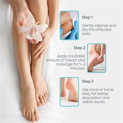 CLASYCARE Topuk Çatlağı Kremi – Kuru ve Çatlamış Topuklar için – E Vitamini ve Avokado Yağlı Topuk Kremi – Nasır, Sert ve Ölü Deriler için Nemlendirici Ayak Bakım Kremi – 100 ml