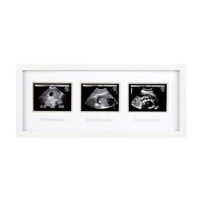 Pearhead 87038 Trimester Sonogram Frame Deluxe, fotoğraf çerçevesi için üç Ultraschallaufnahmen, beyaz