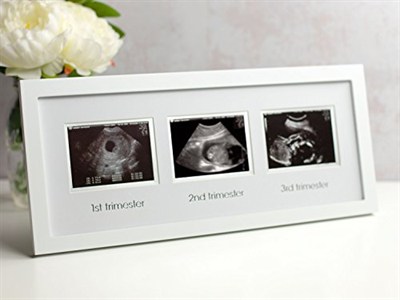 Pearhead 87038 Trimester Sonogram Frame Deluxe, fotoğraf çerçevesi için üç Ultraschallaufnahmen, beyaz