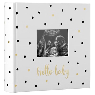 Pearhead Hello Baby Fotoğraf Albümü, Yeni ve Bekleyen Ebeveynler için Bebek Kitabı Hatırası, Cinsiyetsiz Bebek Aksesuarı, 200 Fotoğraf Tutar, Siyah ve Altın Puantiyeli