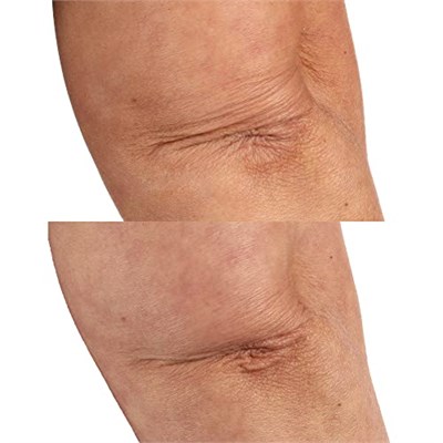 Perricone Md Essential Fx Acyl-Glutathione Vücut Bakım Yağı 118Ml