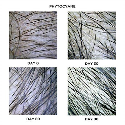 Phyto Phytocyane Densifying Treatment Serum 12 Ampul
