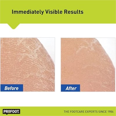 Profoot Argan Yağlı Kokusuz Nemlendirici Ayak Kremi 454GR