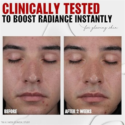 Thayers Glikolik Asit, Laktik Asit ve Cadı Hazel İçeren% 2 AHA Eksfoliye Edici Toner, Tüm Cilt Tipleri için Pürüzsüzleştirici ve Gözenek Arındırıcı Cilt Bakımı, 12 Fl Oz