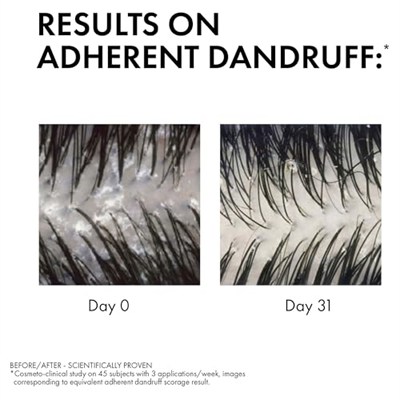 VICHY Dercos Anti Dandruff Kuru Saçlar İçin Kepek Karşıtı Şampuan 200 ml | Salisilik Asit ve Selenyum Sülfür, Kaşıntıyı Yatıştırır, Besler, Dermatolojik