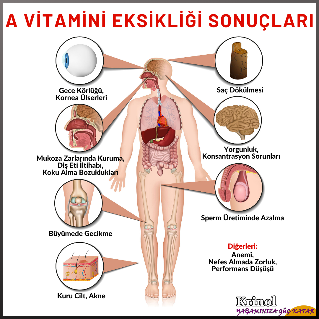 A Vitamini Eksikliği Sonuçları Nelerdir?