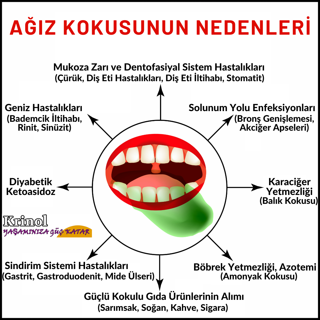 Ağız Kokusunun Nedenleri Nelerdir?