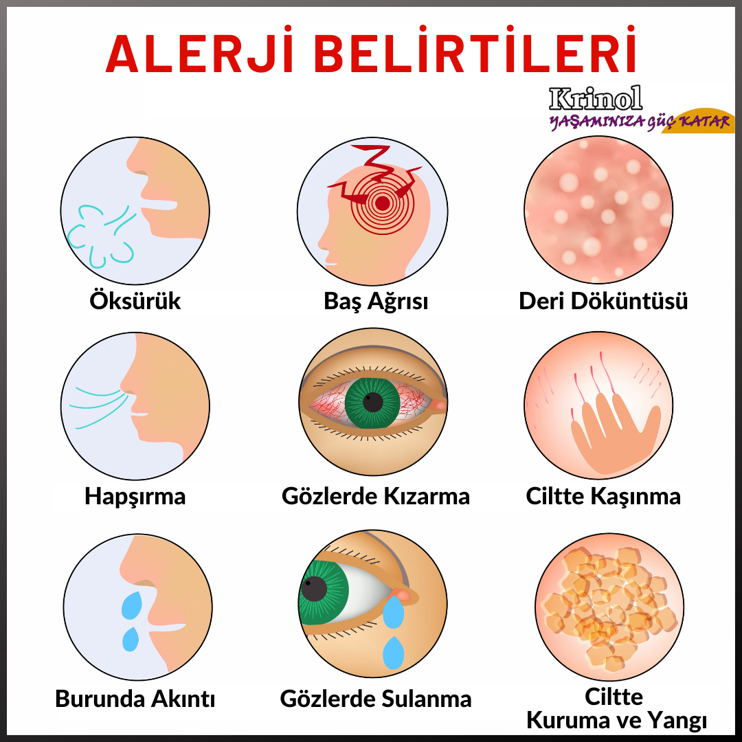 Alerji Belirtileri Nelerdir?