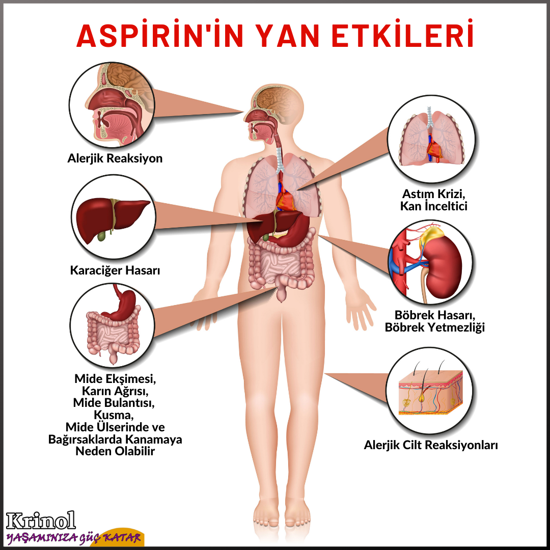 Aspirin'in Yan Etkiler Nelerdir?