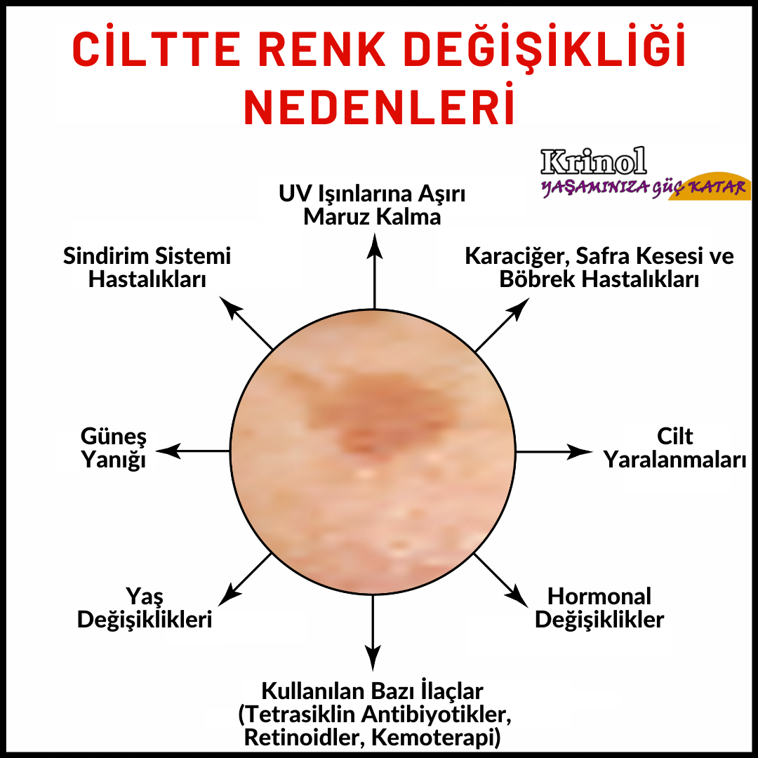 Ciltte Renk Değişikliği Nedenleri Nelerdir?