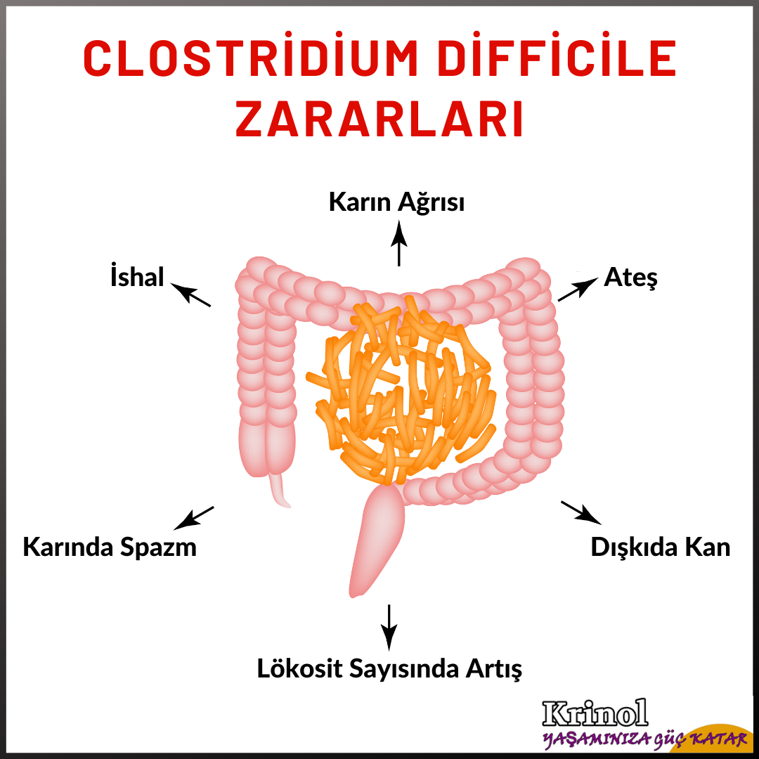 Clostridium Difficile Zararları Nelerdir?