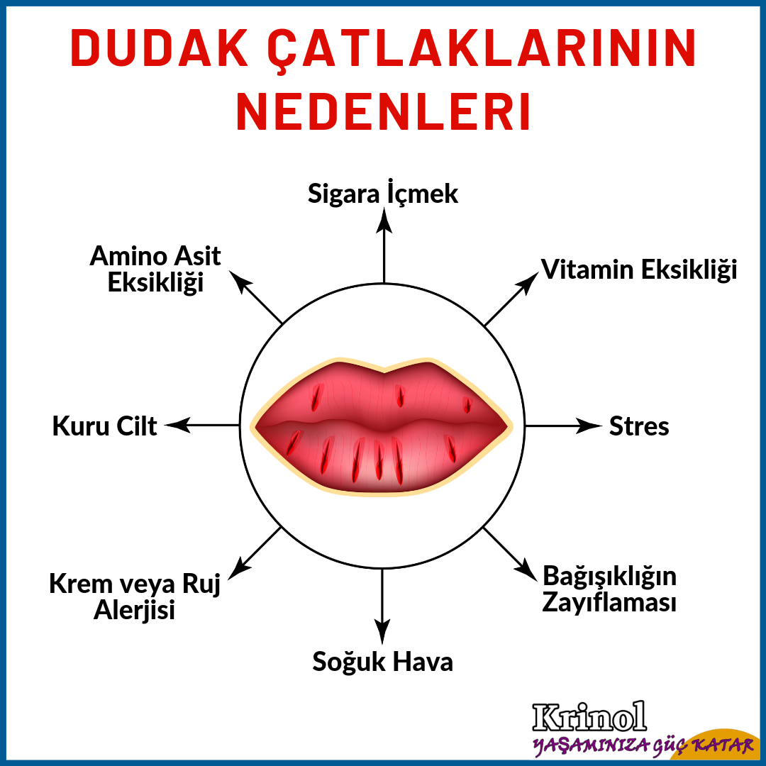 Dudak Çatlaklarının Nedenleri Nelerdir?