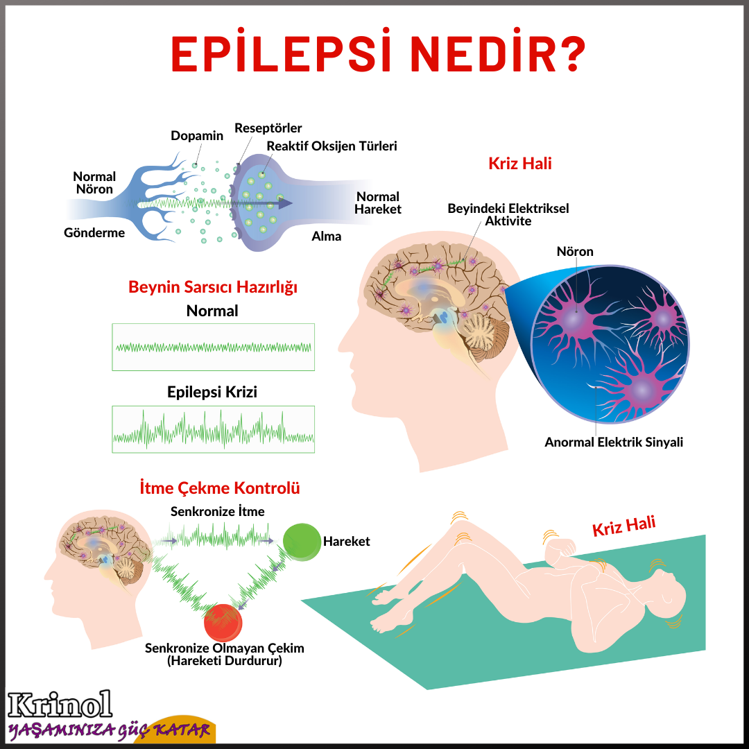Epilepsi Nedir?