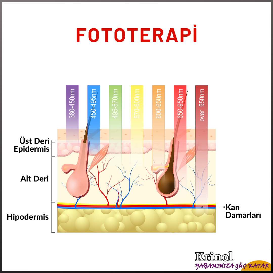 Fototerapi Nedir?