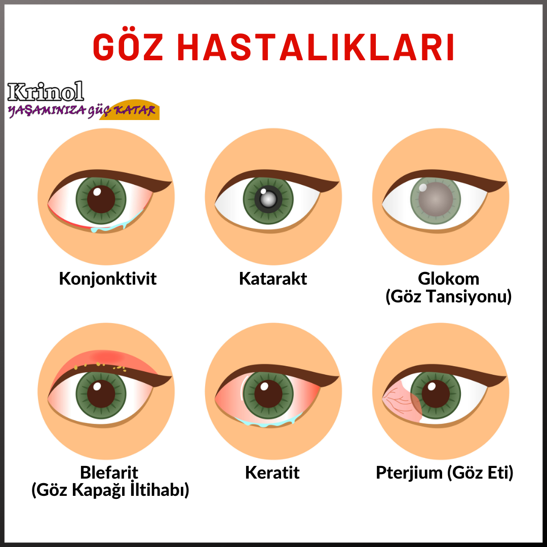 Göz Hastalıkları Nelerdir?