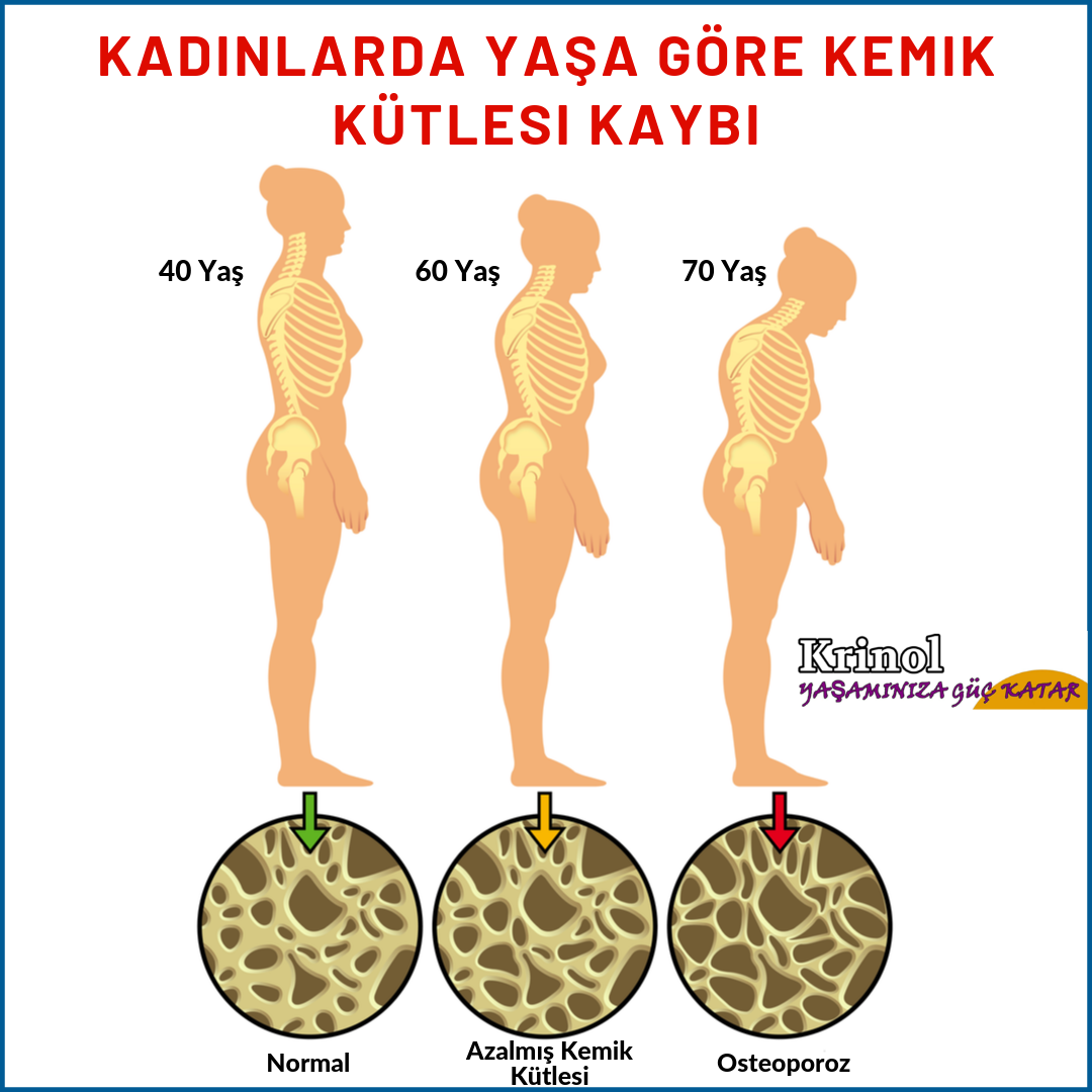 Kadınlarda Yaşa Göre Kemik Kütlesi Kaybı Aşamaları