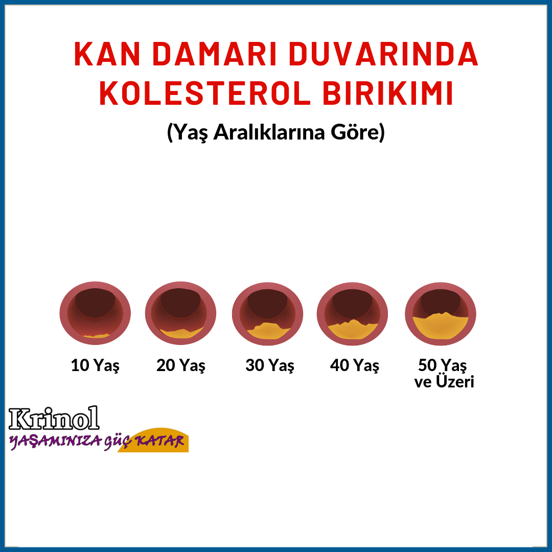 Kan Damarı Duvarında Kolesterol Birikimi (Yaş Aaralıklarına Göre)