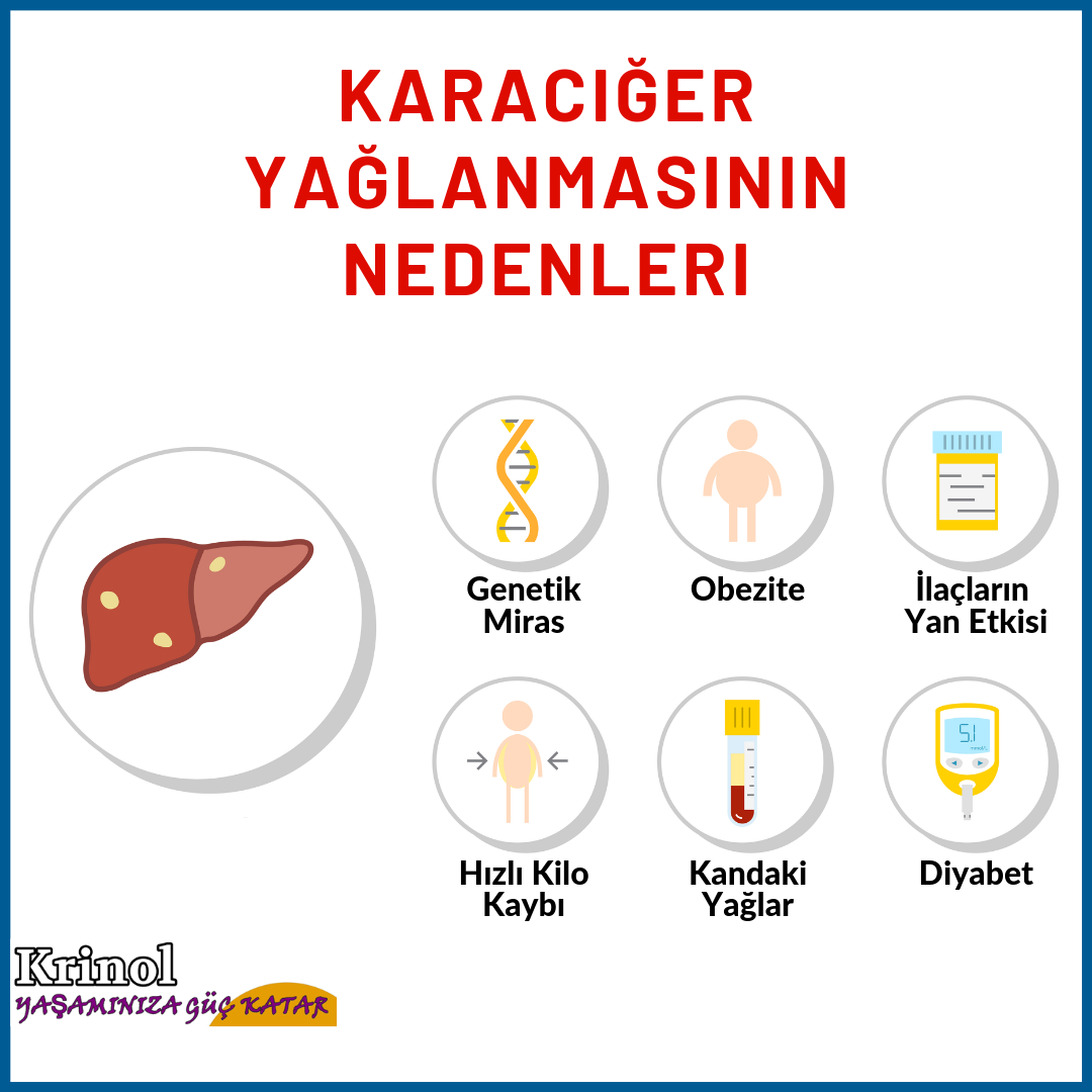 Karaciğer Yağlanmasının Nedenleri Nelerdir?