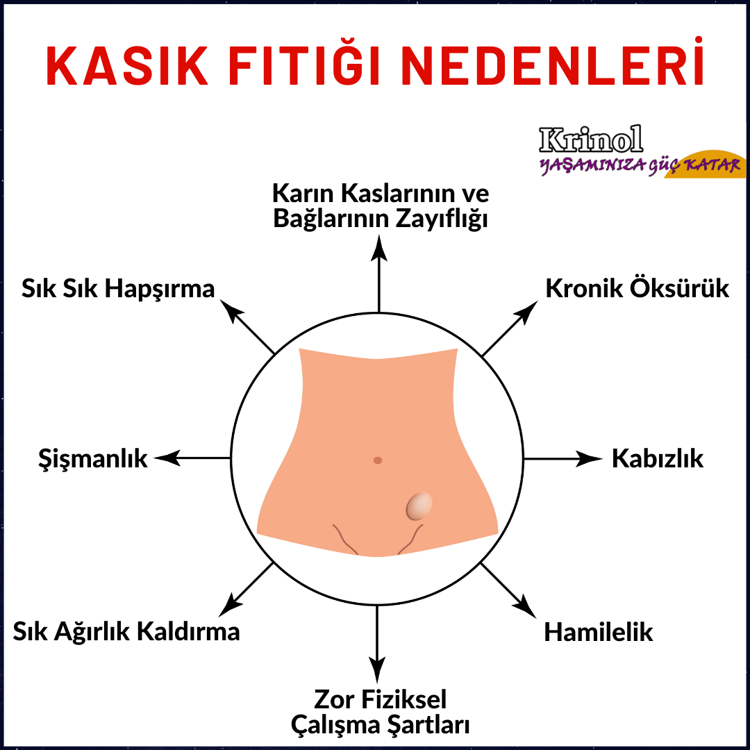 Kasık Fıtığı Nedenleri Nelerdir?