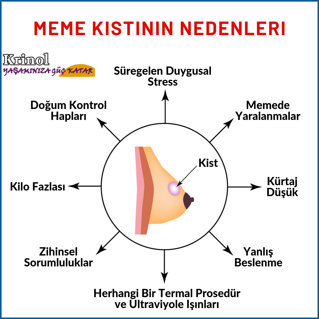 Meme Kistinin Nedenleri Nelerdir?