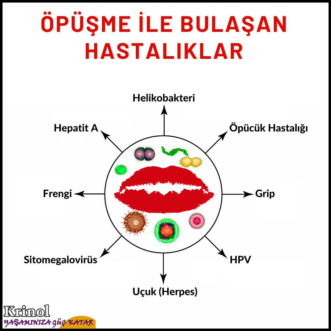 Öpüşme İle Bulaşan Hastalıklar Nelerdir?