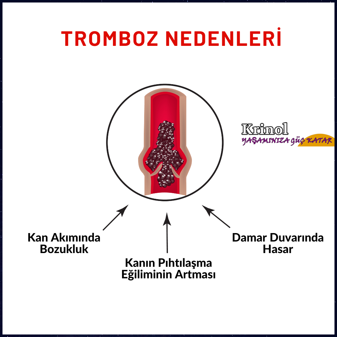 Tromboz Nedenleri Nelerdir?
