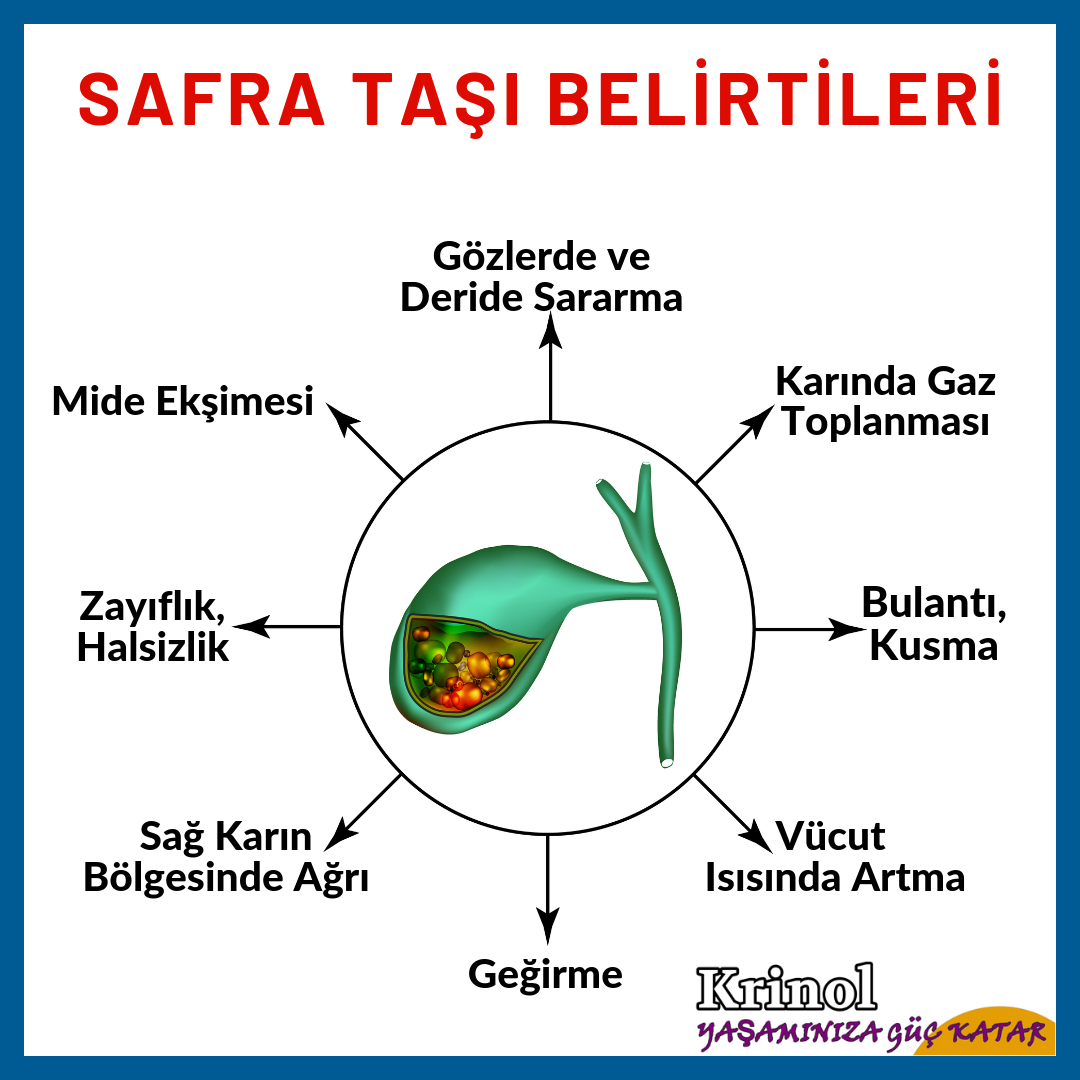 Safra Taşı Belirtileri Nelerdir?