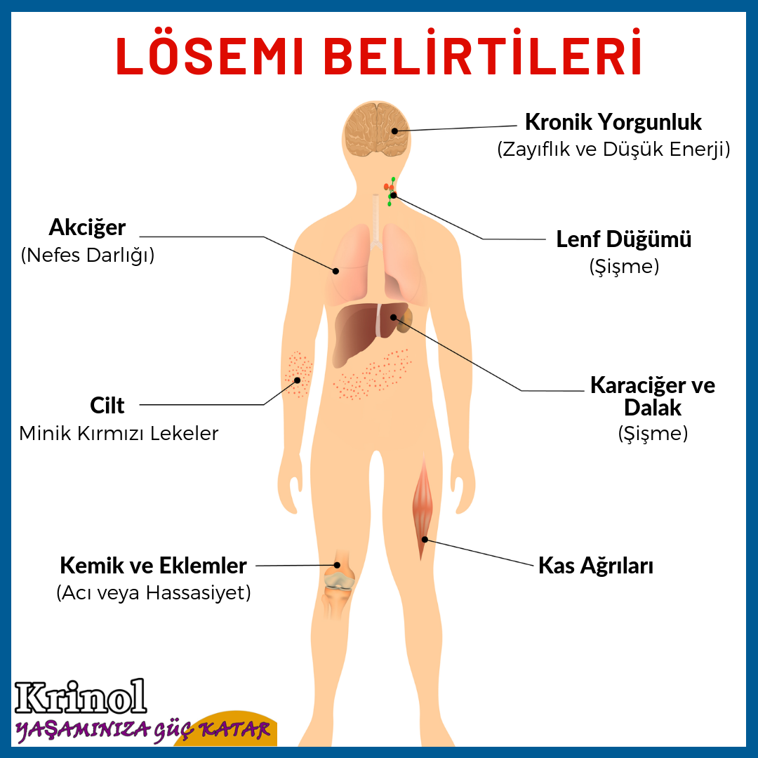 Lösemi Belirtileri Nelerdir?