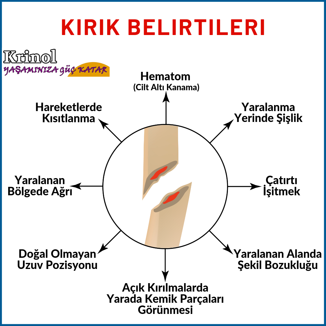 Kırık Belirtileri Nelerdir?