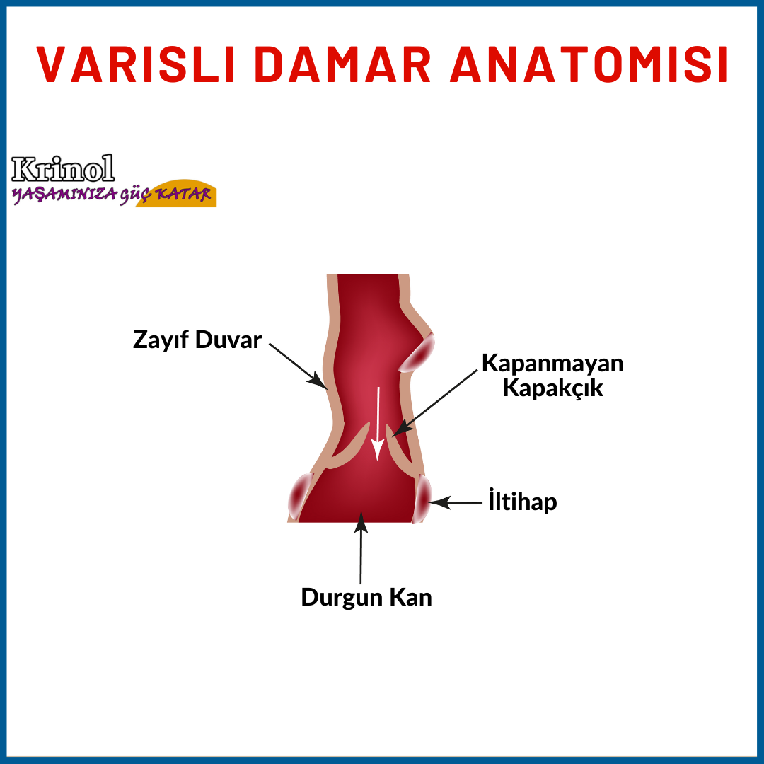 Varisli Damar Anatomisi