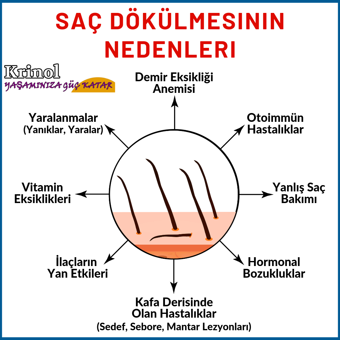 Saç Dökülmesinin Nedenleri Nelerdir?