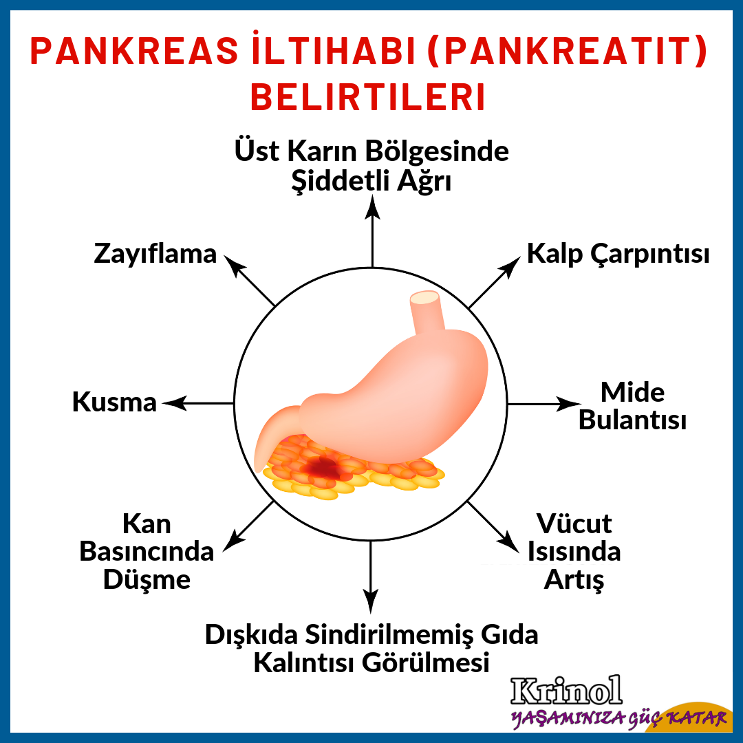 Pankreas İltihabı (Pankreatit) Belirtileri Nelerdir?