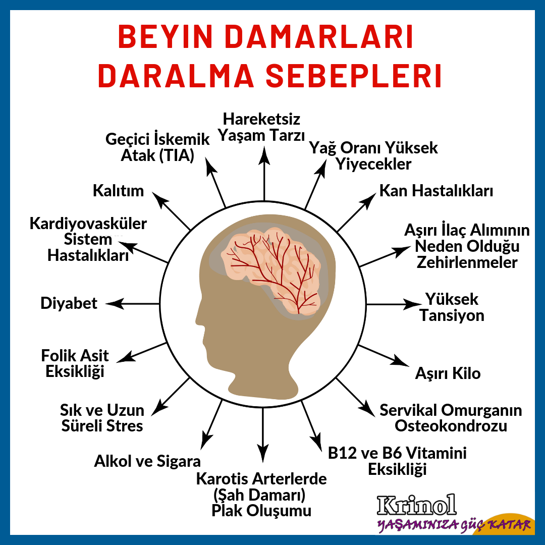 Beyin Damarları Daralma Sebepleri Nelerdir?