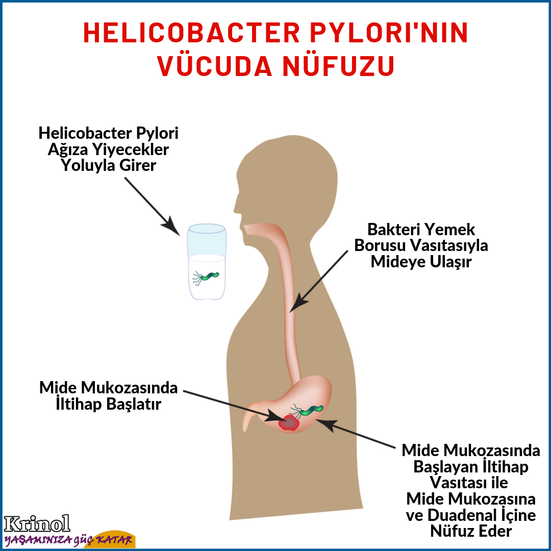 Helicobacter Pylori'nin Vücuda Nüfuzu