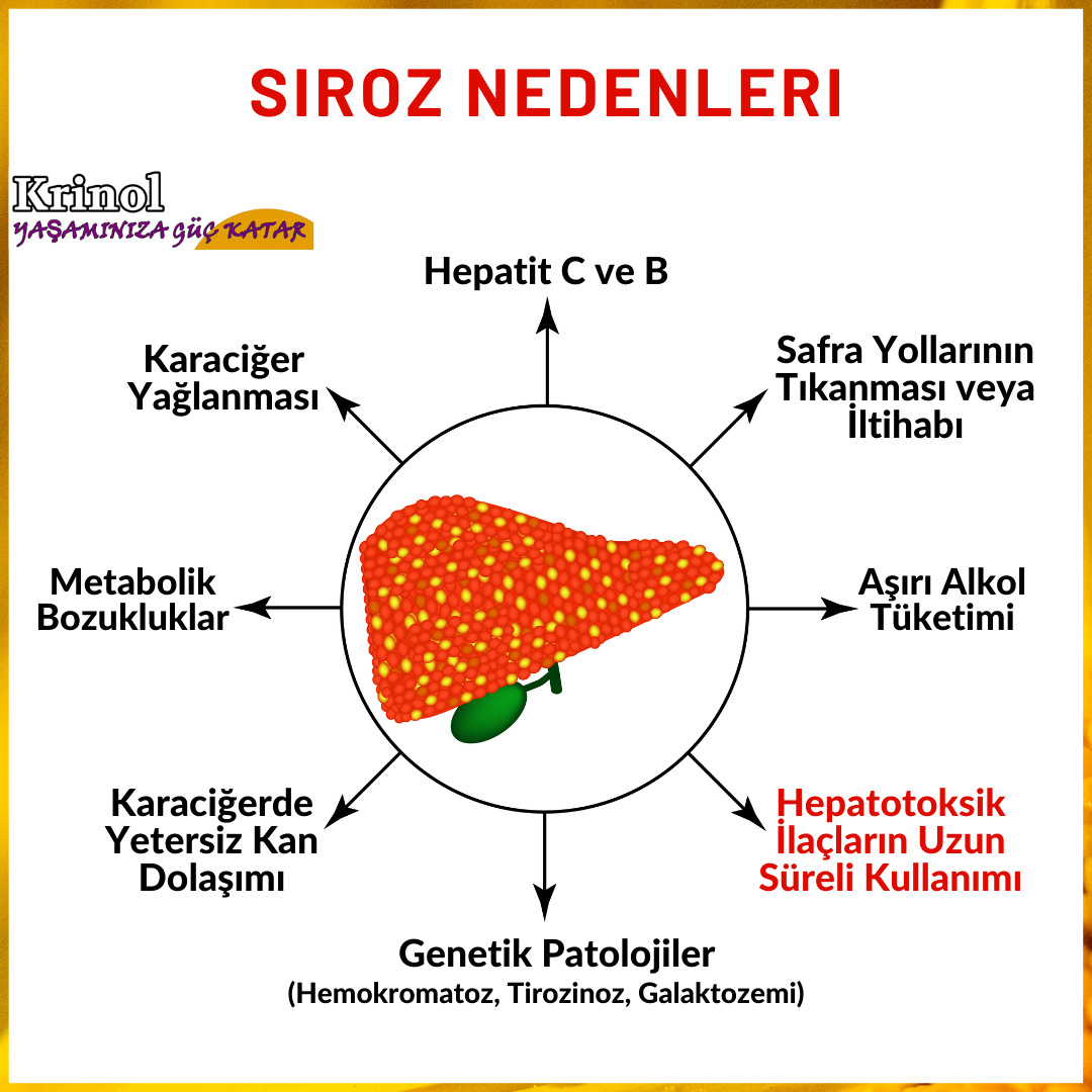 Siroz Nedenleri Nelerdir?