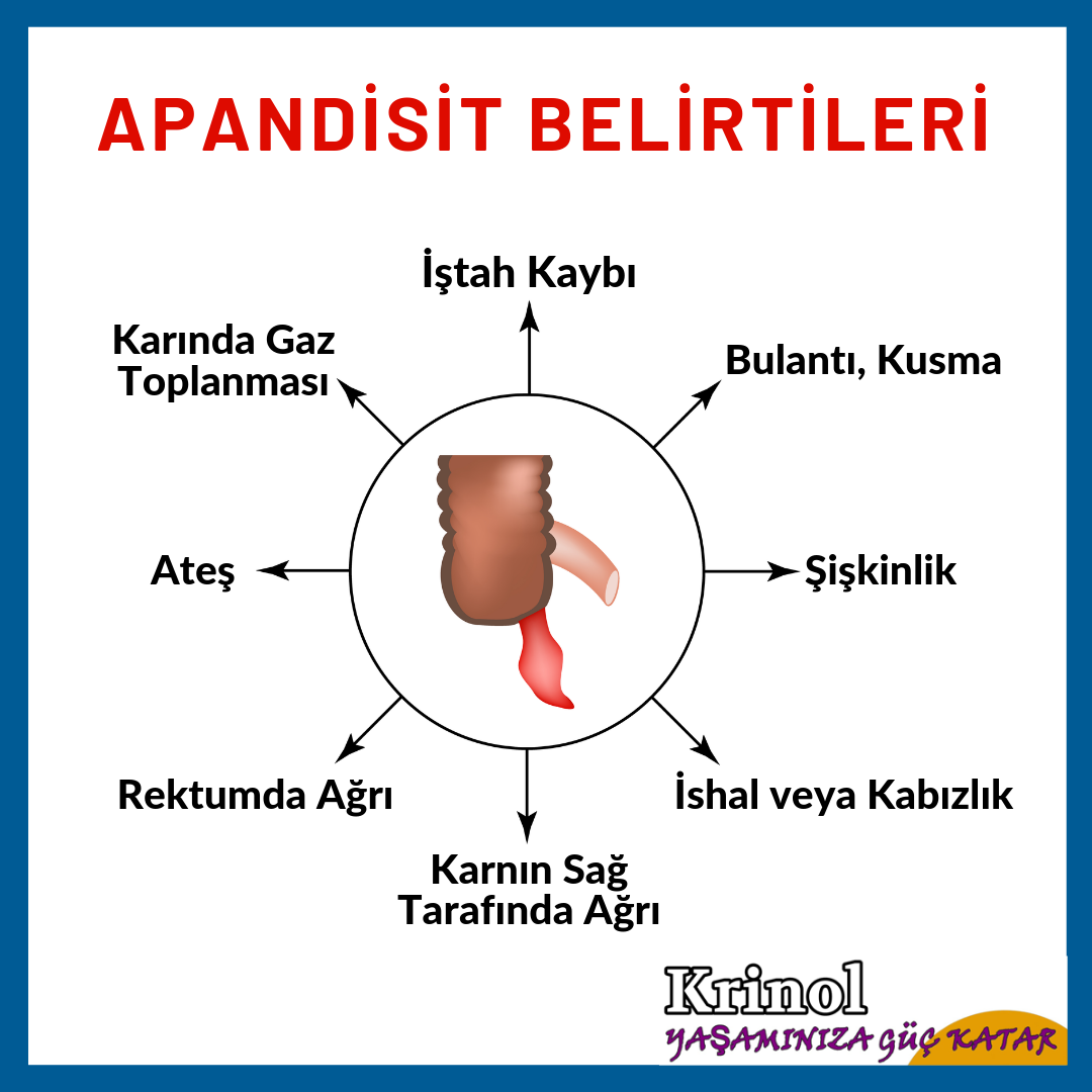 Apandisit Belirtileri Nelerdir?