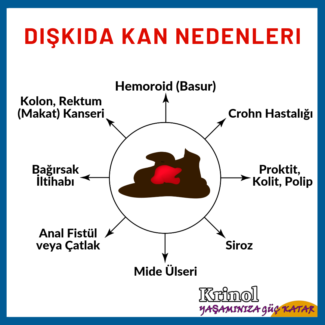Dışkıda Kan Nedenleri Nelerdir?