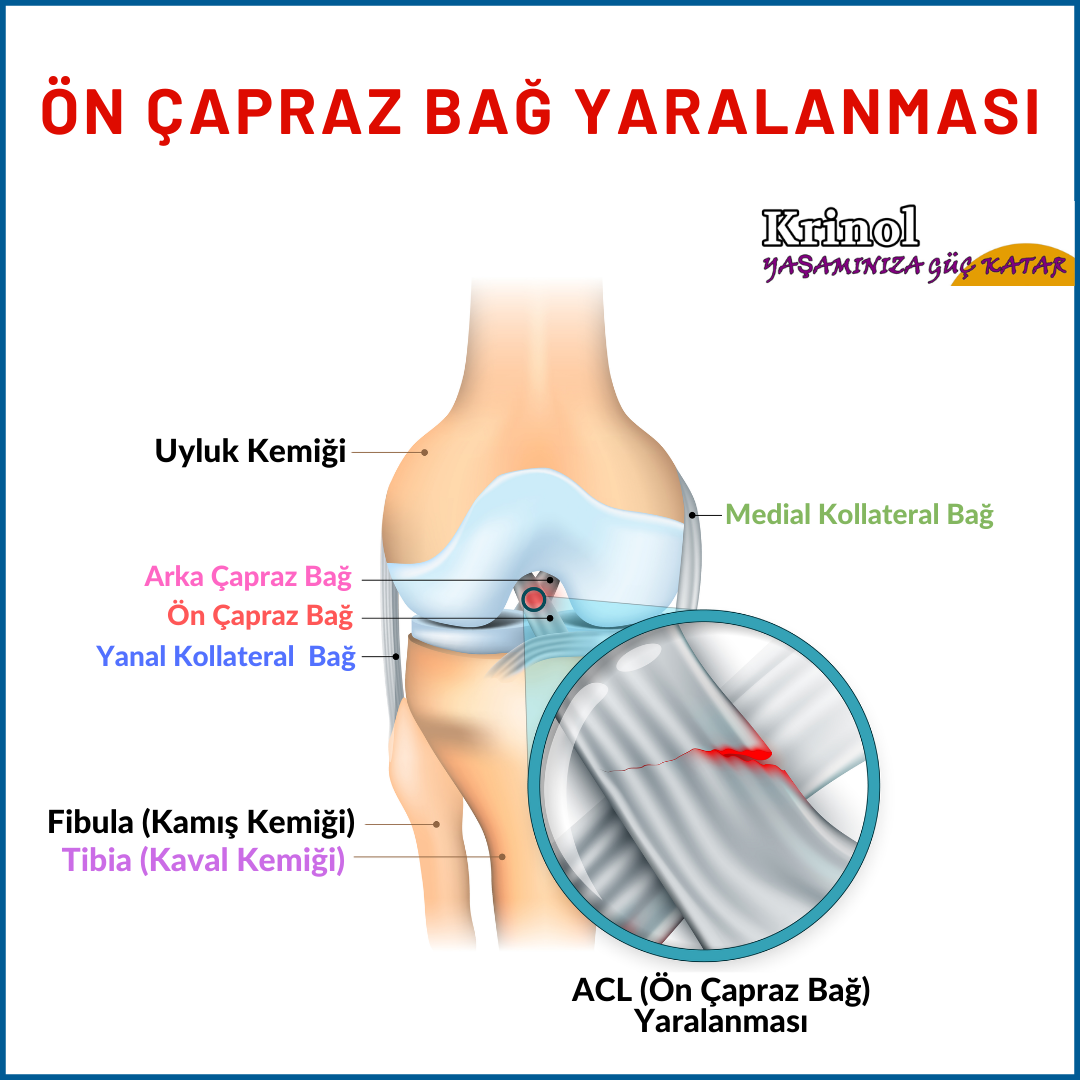 Ön Çapraz Bağ Yaralanması Nedir?
