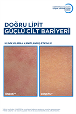 Atoderm AD Intensive Balm Atopik Cilt Kaşıntı Karşıtı Nemlendirici Krem 200 ml