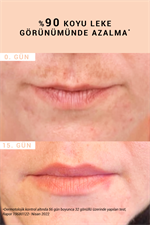 Etat Pur Pure Active Glabridine Leke Karşıtı Aydınlatıcı Saf Konsantre Bakım Serumu 15 ml