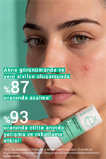 Etat Pur Pure Active Succinic Acid %2 Hassas, Akneli Ciltler Konsantre Bakım Serumu 15ML