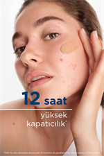 Sebium Kerato+ Cover Sivilce, Akne Lekesi Karşıtı Renkli Nemlendirici Krem 30 ml