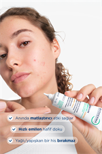 Sebium Kerato+ Cover Sivilce, Akne Lekesi Karşıtı Renkli Nemlendirici Krem 30 ml