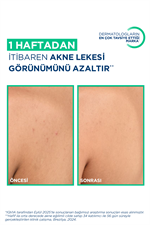 Sebium Kerato+ Body Sivilce ve Akne Lekesi Karşıtı Ferahlatıcı Vücut Spreyi 150 ml